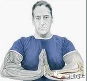 打通胳膊经络锻炼动作和方法,手臂经络不通松解法教程