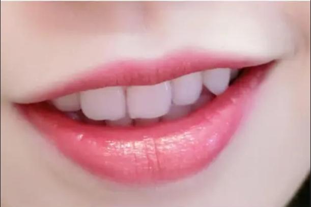 用什么方法牙齿变白,小苏打牙齿变白的方法