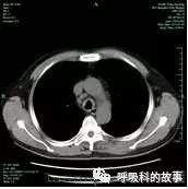 平台型的变化是什么,平台功能有什么新的变化