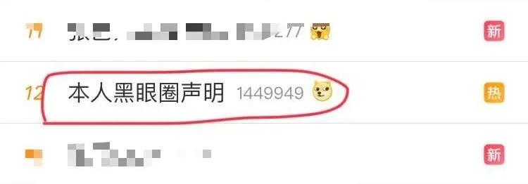 假期提示|放假熬夜冠军又要来了,黑眼圈到底怎么来的心里没点数吗?