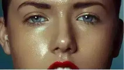 长了粉刺怎么处理,长了闭合粉刺性痤疮怎么办