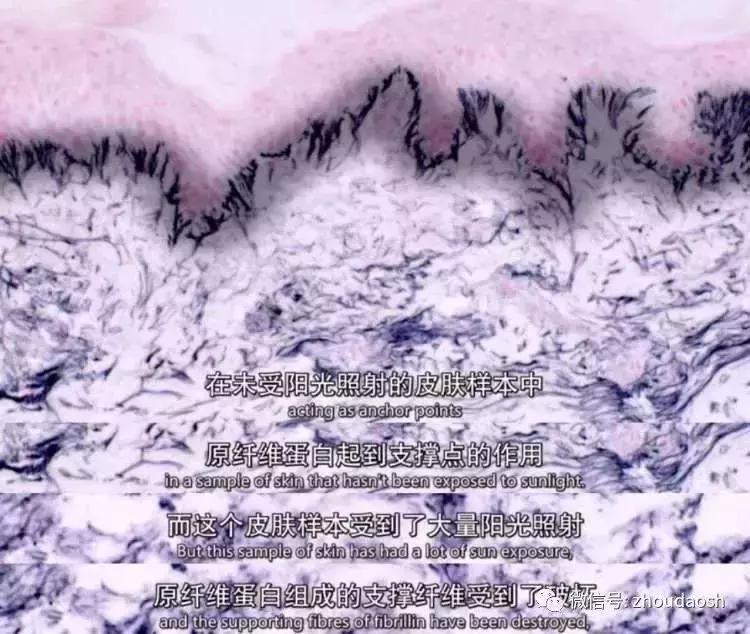 bbc纪录片整形美容的真相,美容治疗的真相bbc