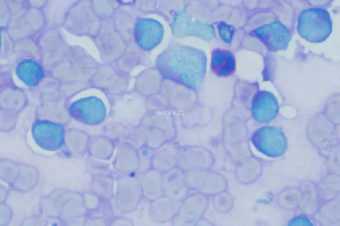 粒单不决问组化?有时还真不一定...