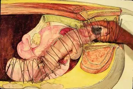 母猪助产钳的使用视频,手把手教你给母猪授精