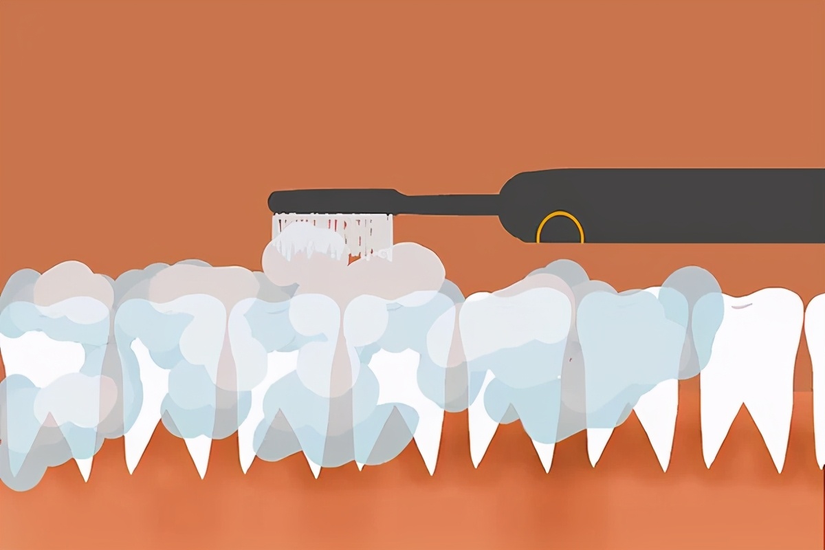 口臭是怎么回事如何解决口臭问题,口臭是什么原因用什么方法治口臭