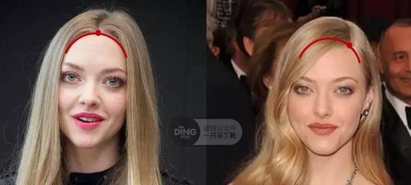 颅顶太低如何自救,颅顶低怎么自救