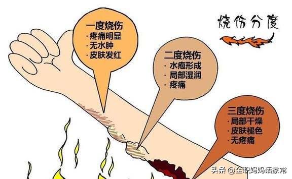 小孩被油烫伤怎么处理好得快,2岁孩子被油锅烫伤