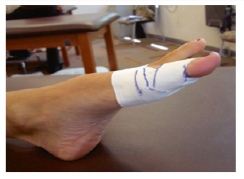 拇趾跖趾关节痛是怎么回事,拇脚趾关节疼痛是怎么回事