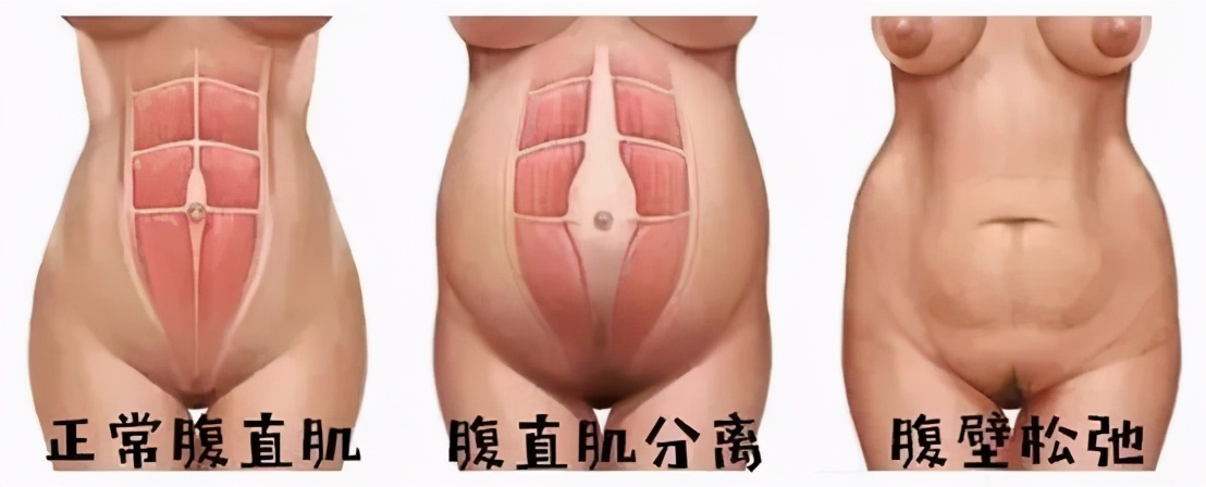 唐艺昕产后复出状态好,唐艺昕产后几个月复出