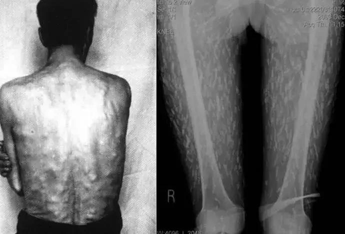 实录：不要命的漂亮，害了一群女孩