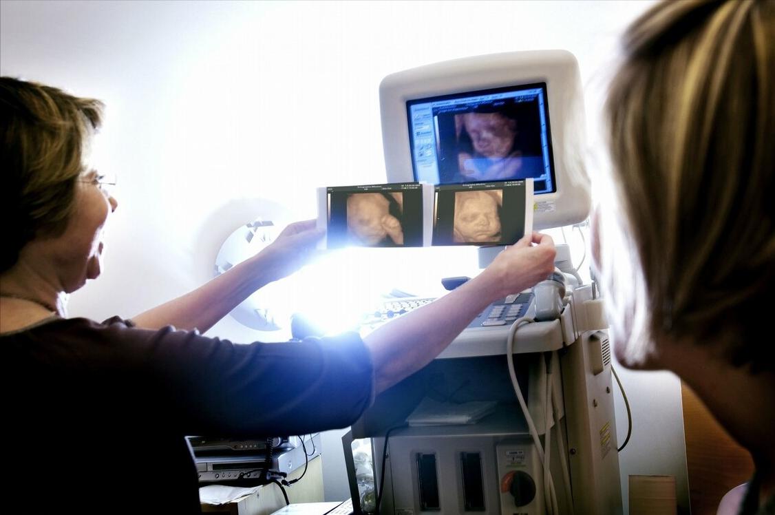 怀孕了能不能做b超,怀孕做b超要憋尿吗