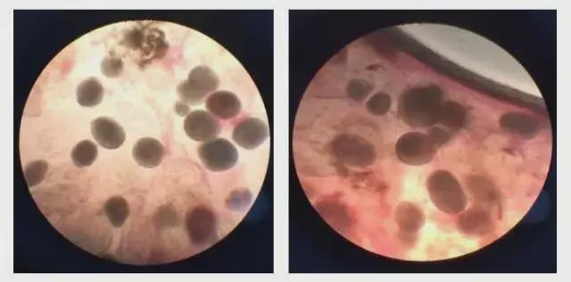 秋后猛于虎，小心这个病秋后算账，你做好准备了吗？