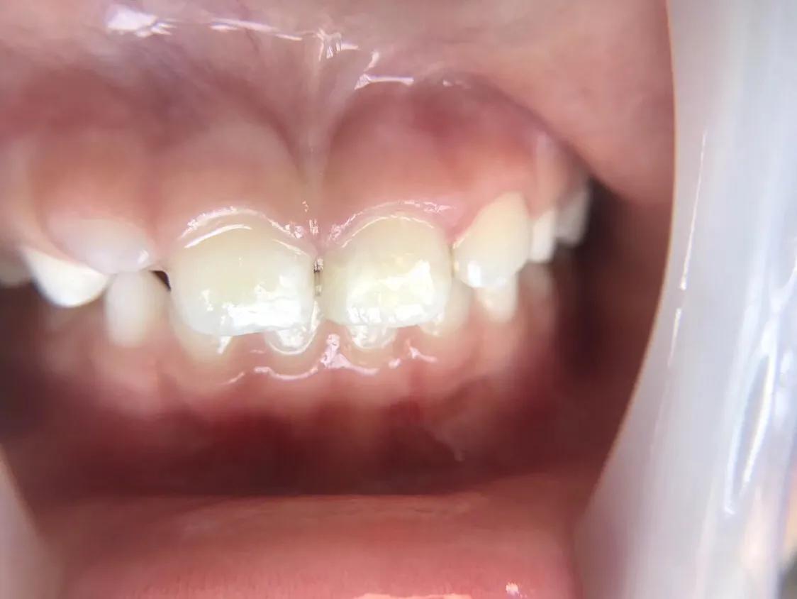 口腔垃圾怎么处理,口腔护理中的垃圾怎么分类处理