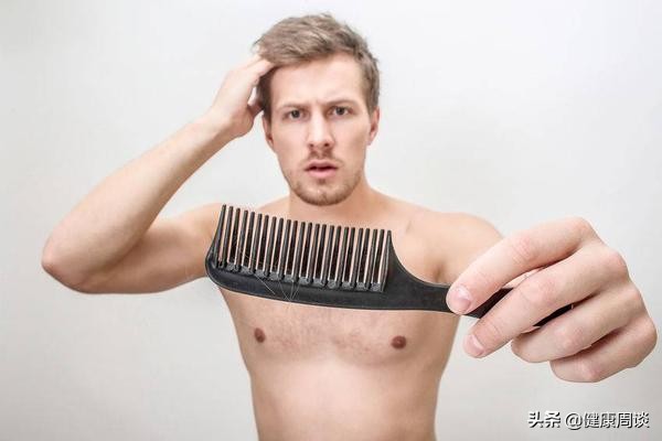 男人年轻就秃顶的原因是什么,为什么只有男性会秃顶