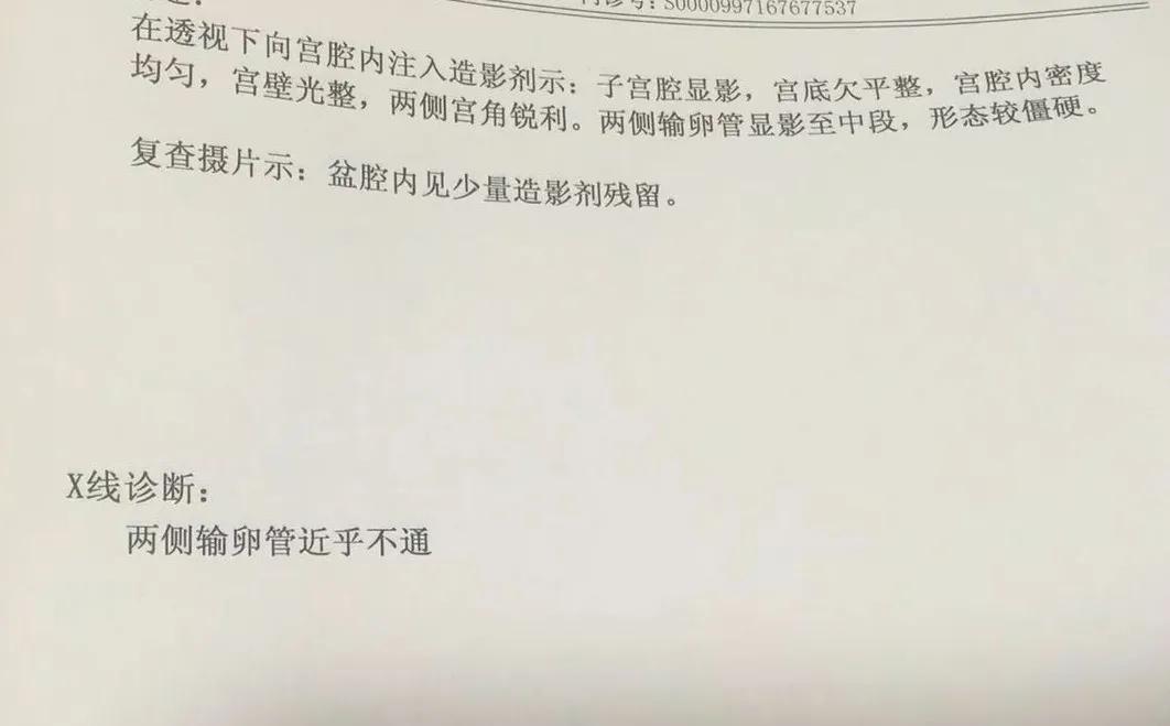 当取卵针戳进我的卵巢,把卵泡一颗颗吸出来时,丈夫在隔壁取精室看片取精|成为母亲
