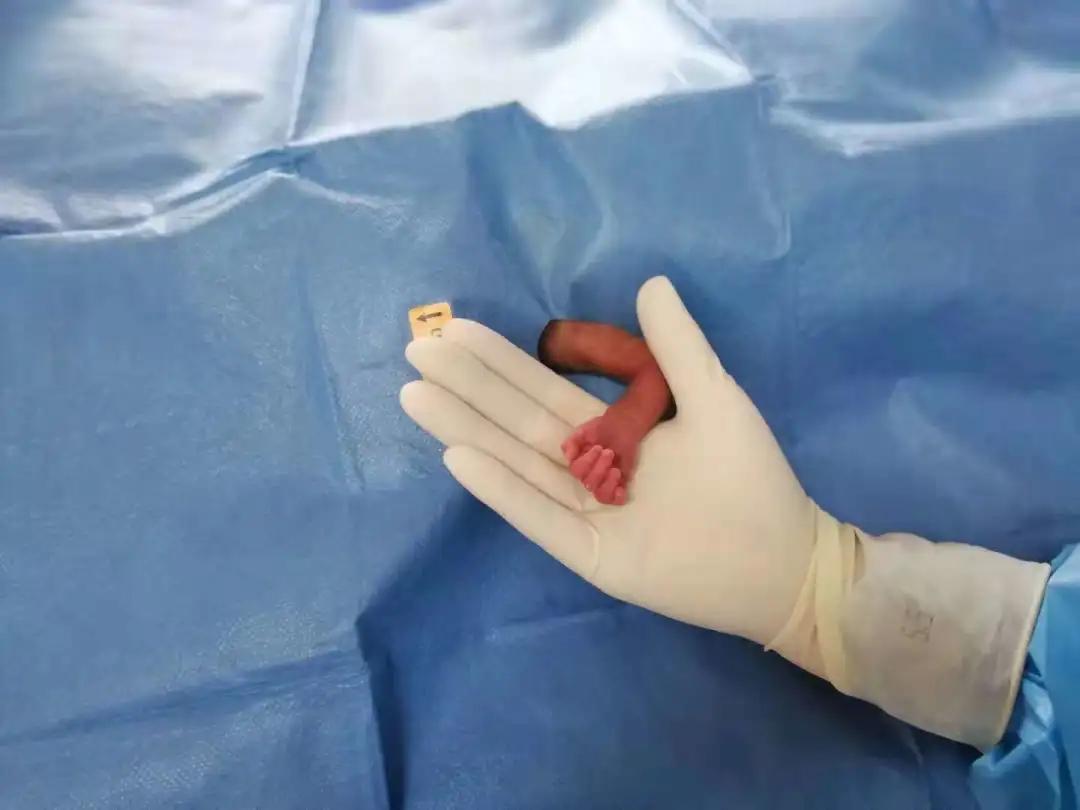 先兆早产保胎喝中药有用嘛,先兆早产保胎怎么控制血糖