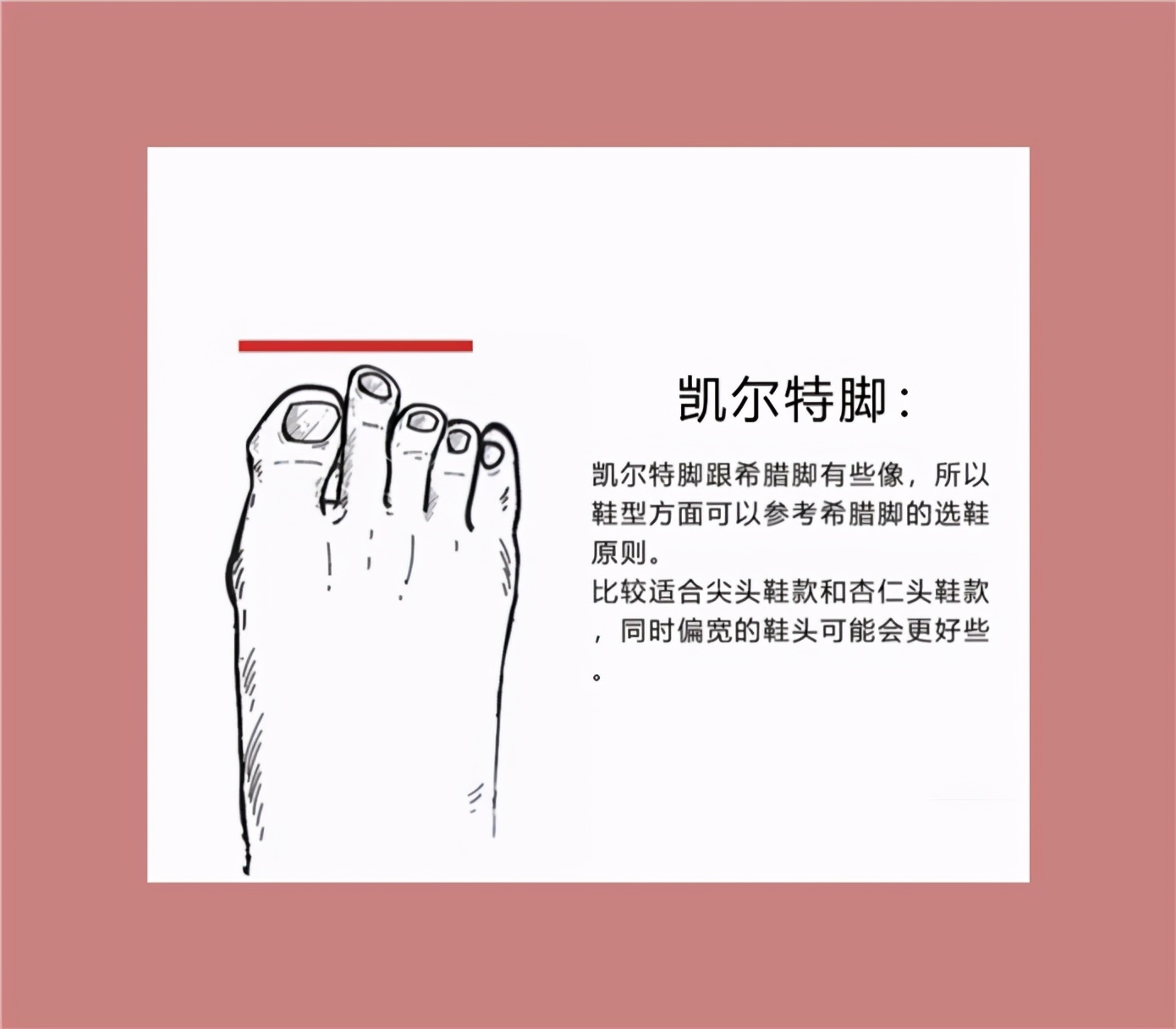 不同脚型适合的鞋子,鞋子不一定要贵只要合脚就行