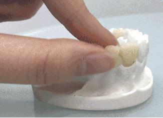 医生说我少一颗牙怎么回事,医生说我少了一颗牙