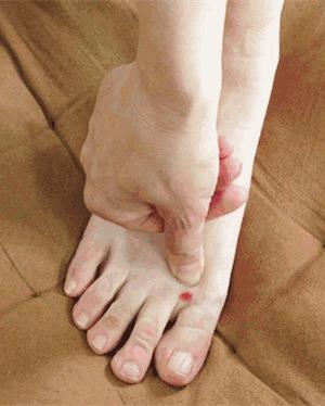 下颌角疼一按就疼嘴巴张不开,下颌疼张口受限