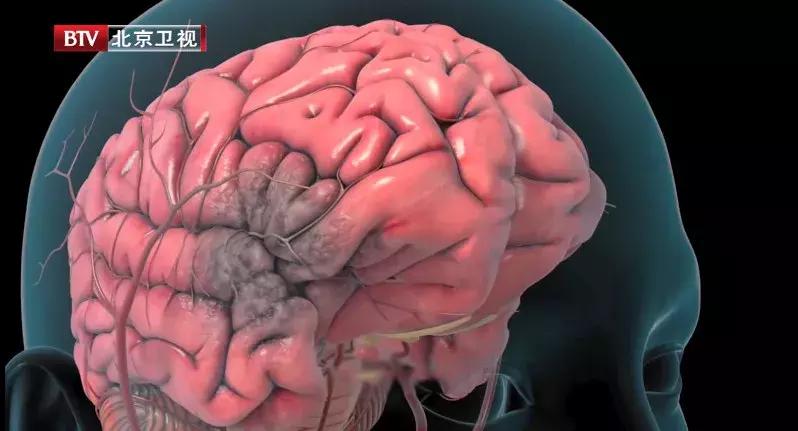 高血压一时好一时坏怎么回事,高血压可能是一过性的吗