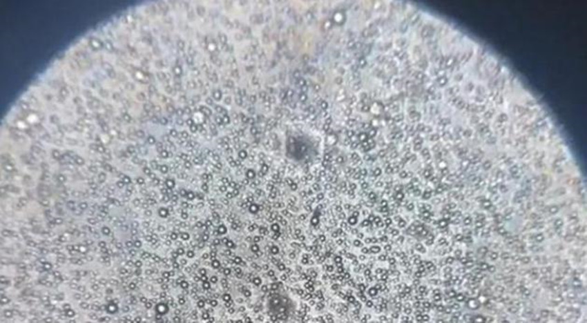 母乳在显微镜下的发现,母乳显微镜下的状态