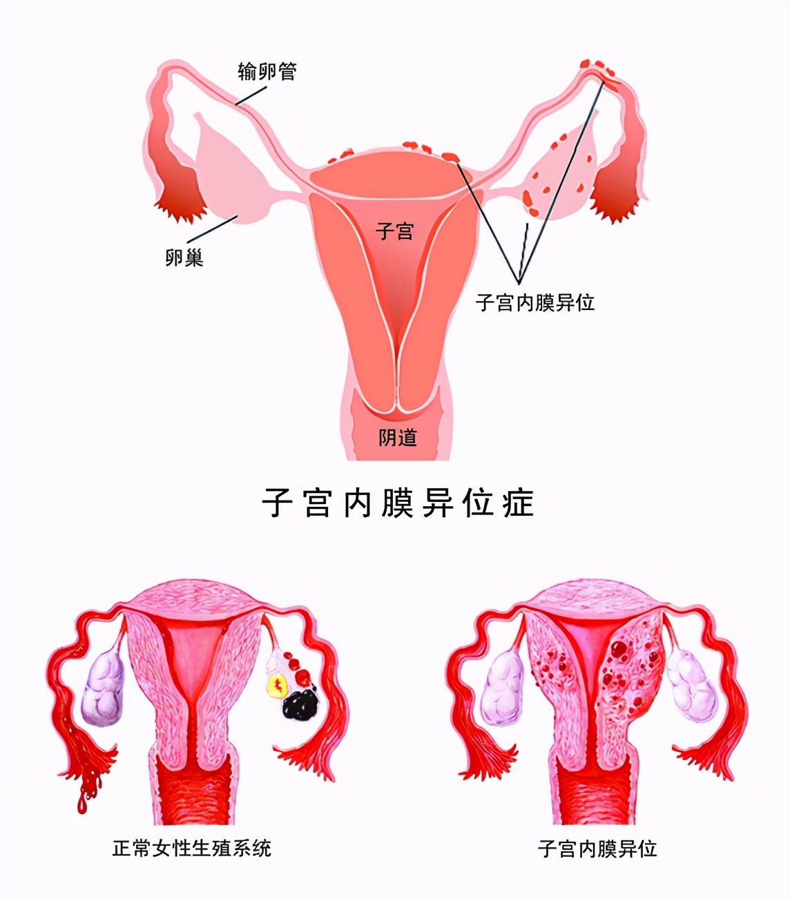 女人的痛不是你能体会的,女人的痛不过是为你而痛