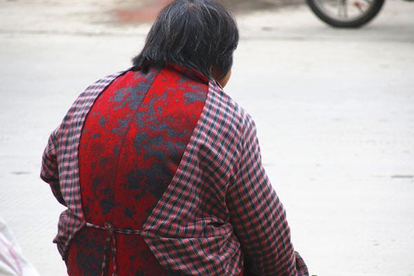 摆脱老年斑最靠谱的5个方法,老年斑不要恐慌