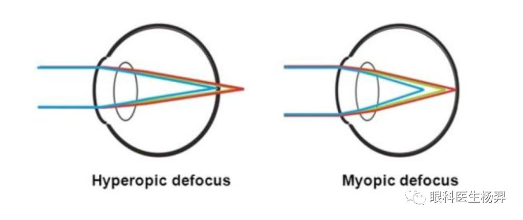 防范近视的户外活动,户外活动防控近视背后的秘密