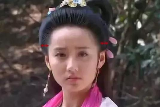 颅顶太低如何自救,颅顶低怎么自救