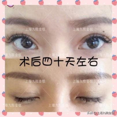 双眼皮VS单眼皮，为什么更多人喜欢双眼皮？