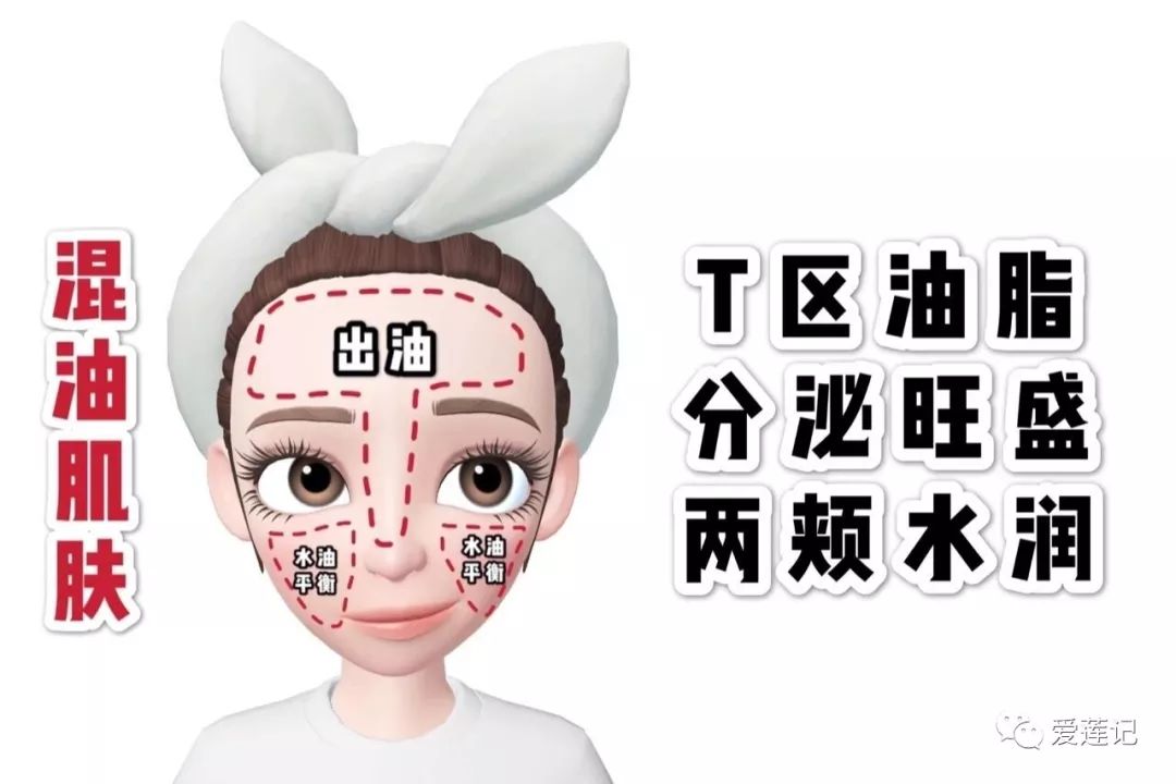 青春期黑头痘痘闭口毛孔粗大出油,油光满面毛孔粗大黑头闭口怎么办