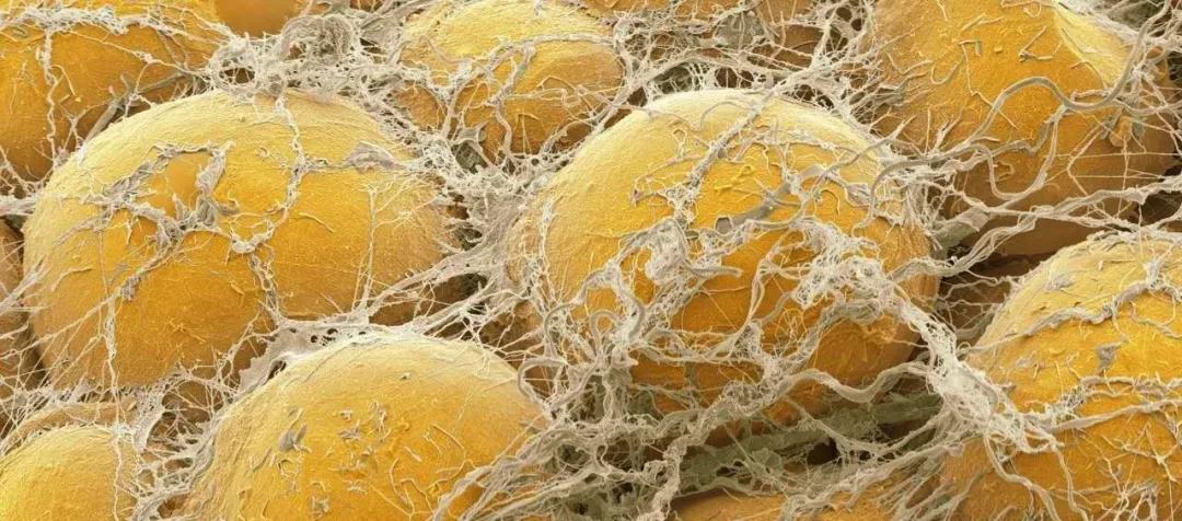 三万多塑身衣老公吓哭要离婚：“脂肪流动”还要坑多少女人？！