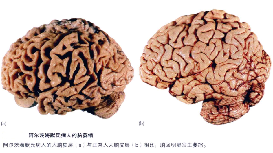 心理学的生物学基础知识,生物心理学知识书籍