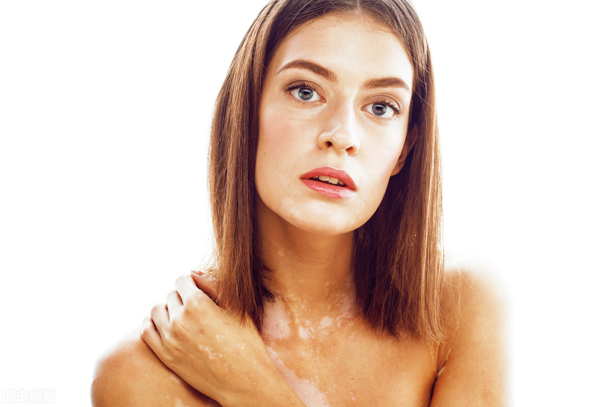 手臂白癜风早期的症状,白癜风该怎么治疗