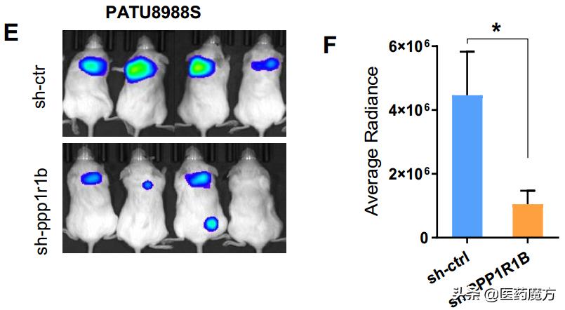 胰腺癌新靶点,胰腺癌tp53基因突变靶向药