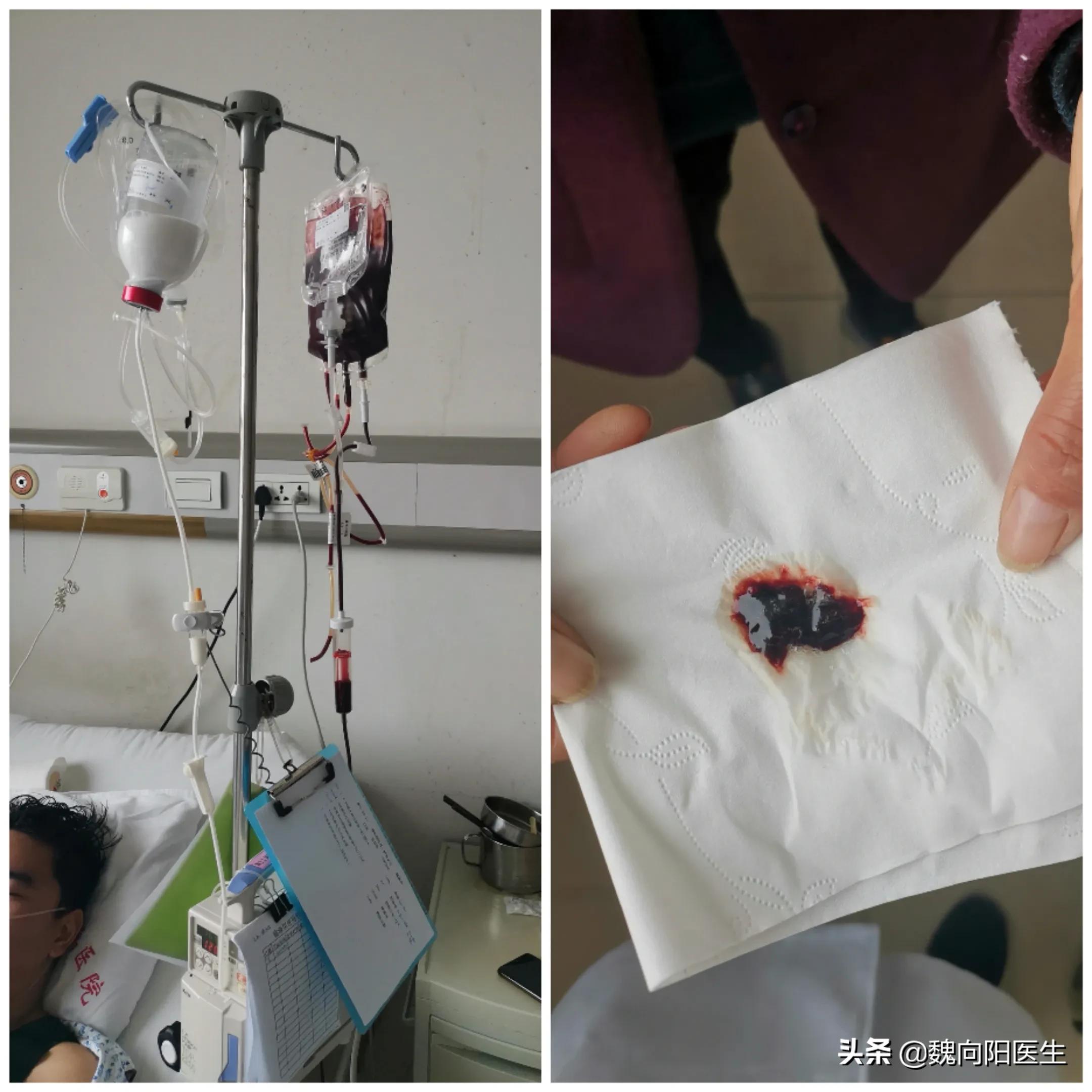 输了3000ml血,也没能留住他一条命,最终也没等到输血小板