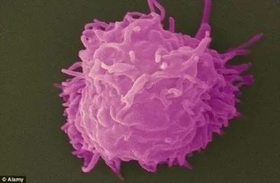 长期戴隐形眼镜眼睛里长满了溃疡,戴隐形眼镜长寄生虫前有哪些症状