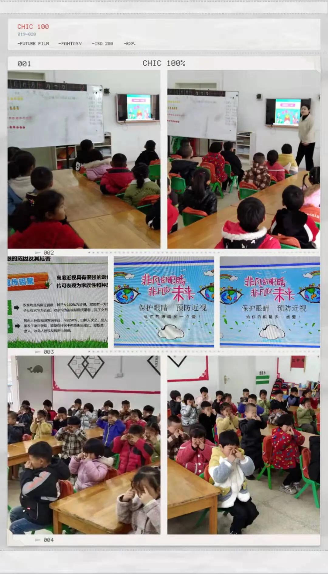 幼儿园爱护眼睛宣传资料,幼儿园爱护眼睛信息报道