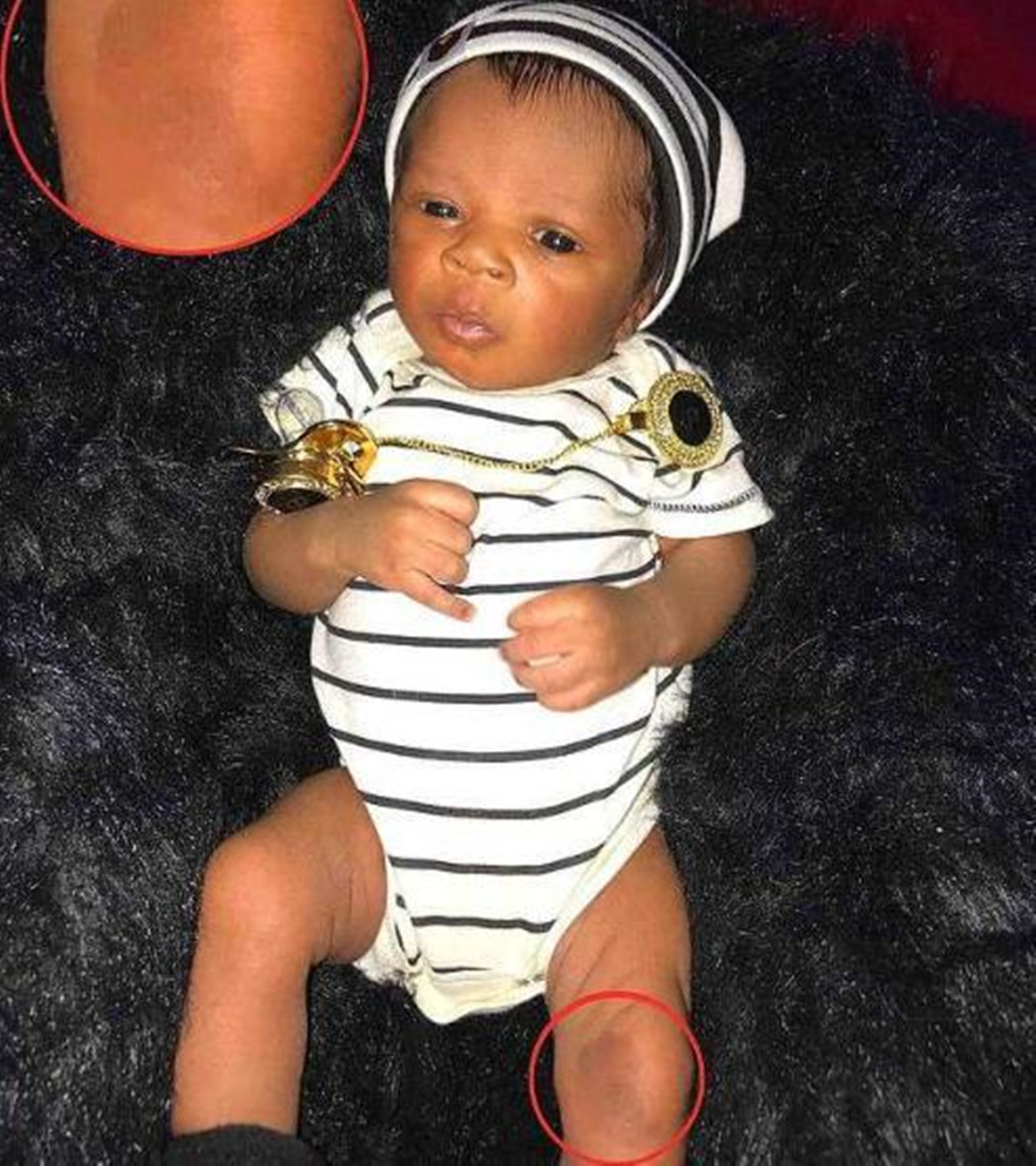 b超查得出胎儿长胎记吗,龙凤胎姐姐怀孕弟弟孕吐