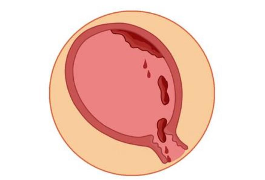 分娩后多久会排出乳汁,分娩后多长时间排气