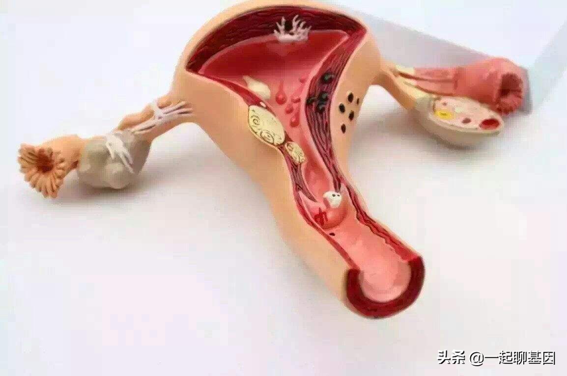 子宫肌瘤是怎么回事,子宫肌瘤为什么医生都不开药治疗