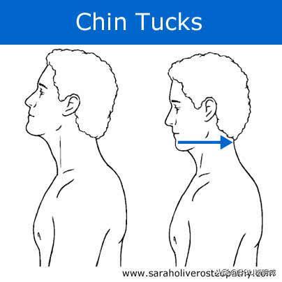 躺床头前倾矫正,怎么纠正头前倾