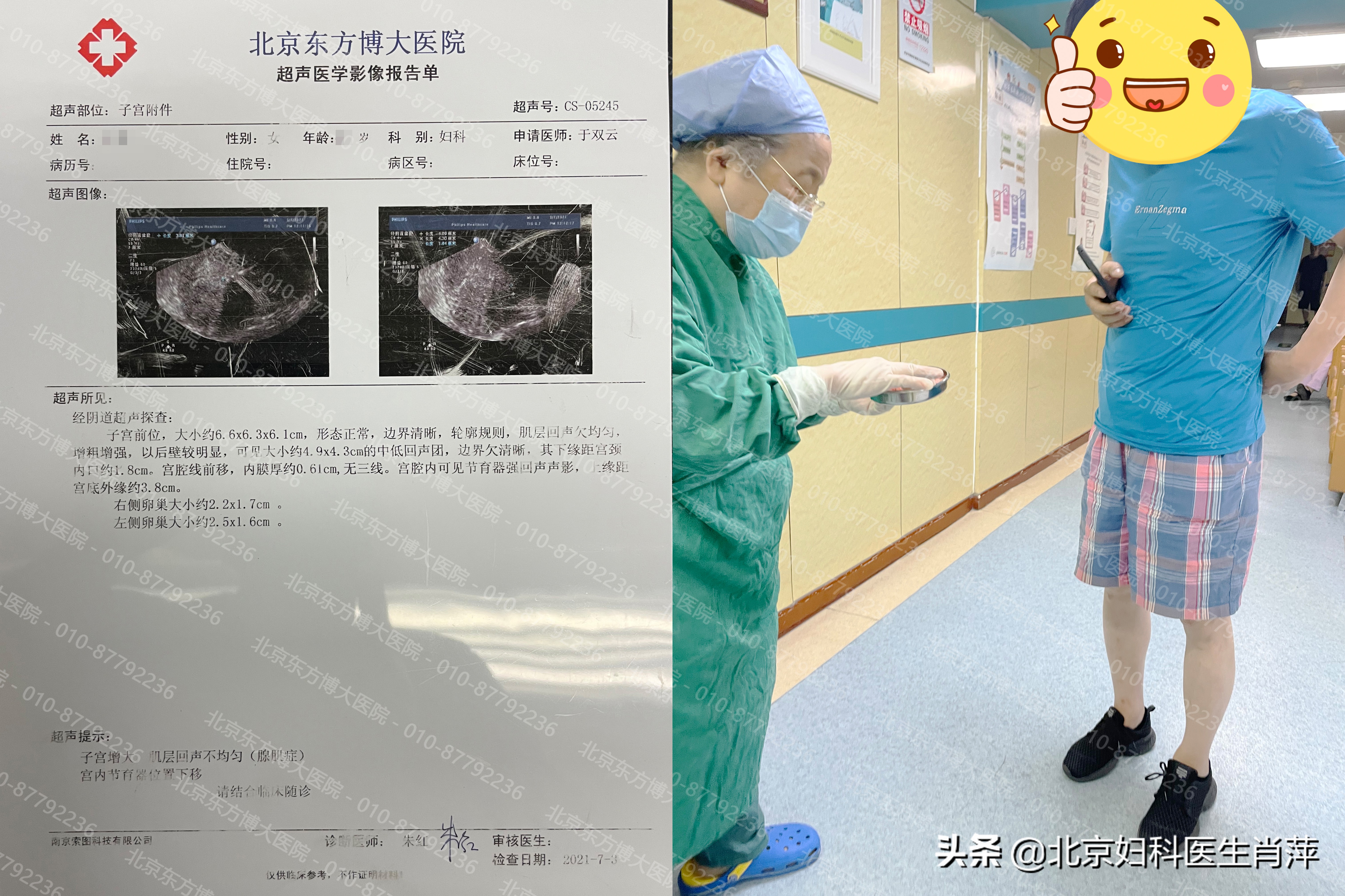 孙爱达教授治疗腺肌症怎么样,孙爱达腺肌症手术靠谱吗