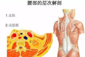 腰椎弯曲有什么后果,腰椎弯曲该如何复位