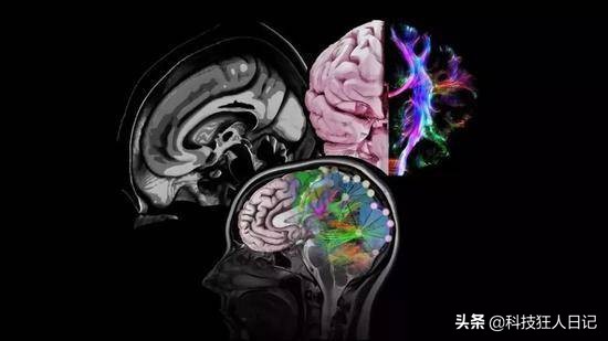 终结阿兹海默症 (为啥会患上阿兹海默症)