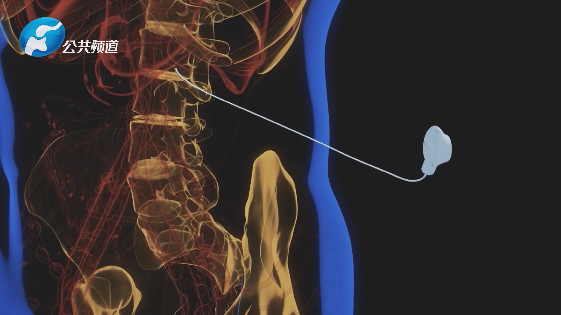 最心疼你的人是我：河南省肿瘤医院疼痛科副主任谢广伦博士