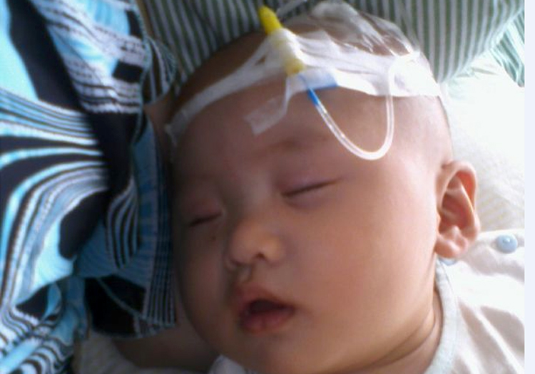 婴儿输液扎头会不会伤到神经,小孩输液可以扎脑袋吗