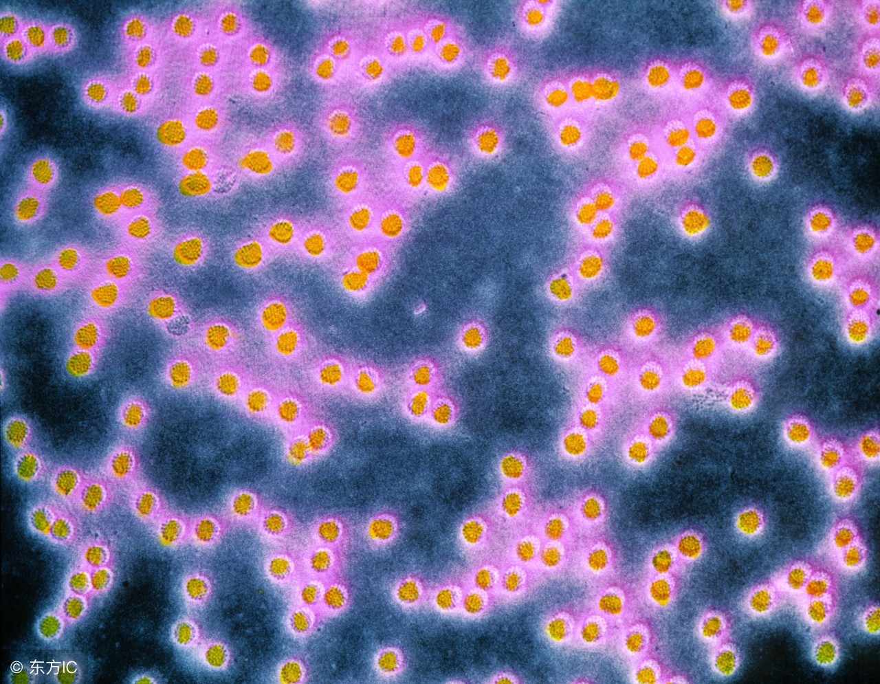 扁平疣怎么去除最快最有效,扁平疣如何去除