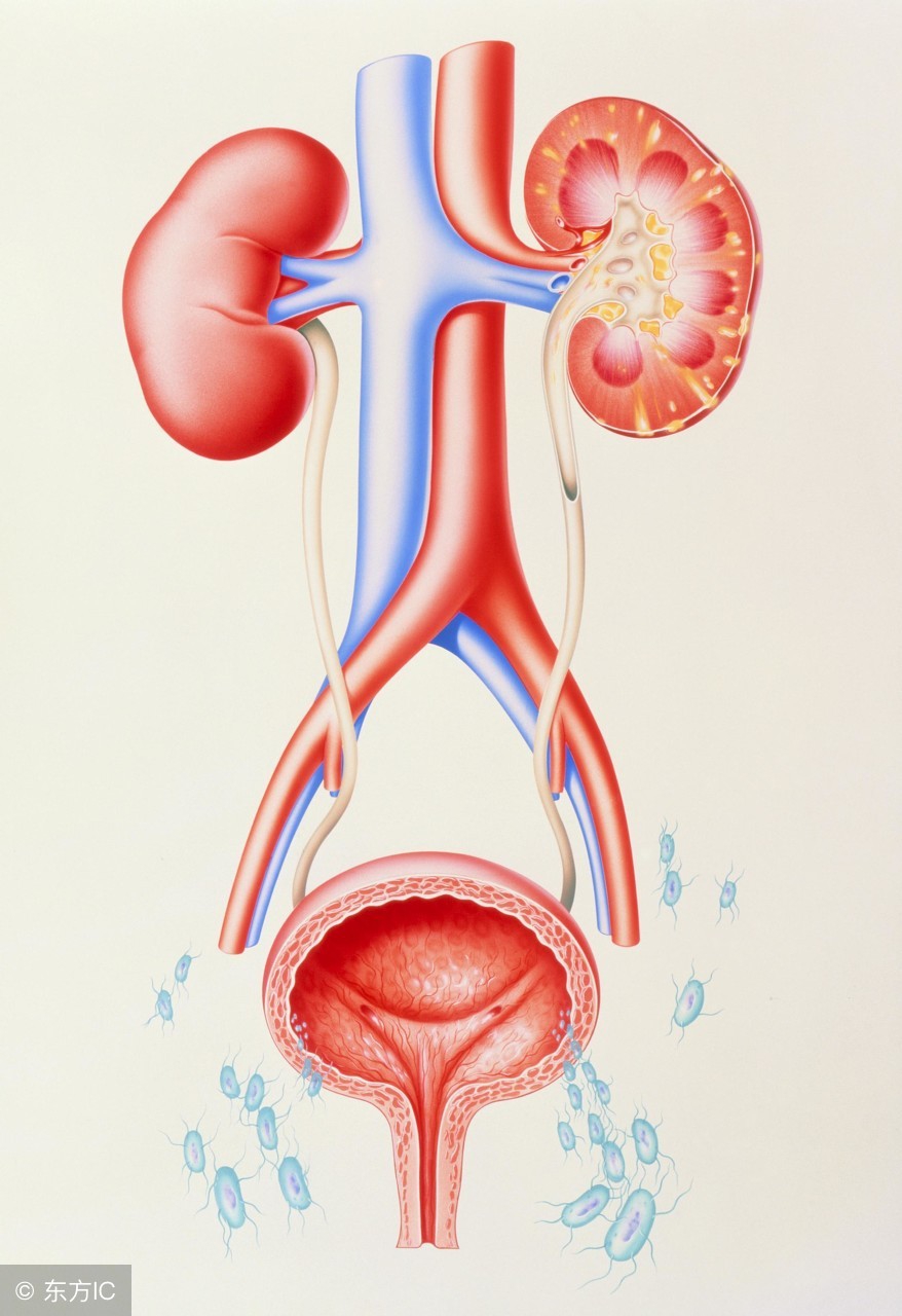 尿频尿急是尿路感染引起的吗,尿路感染都是出现尿急尿频尿痛吗