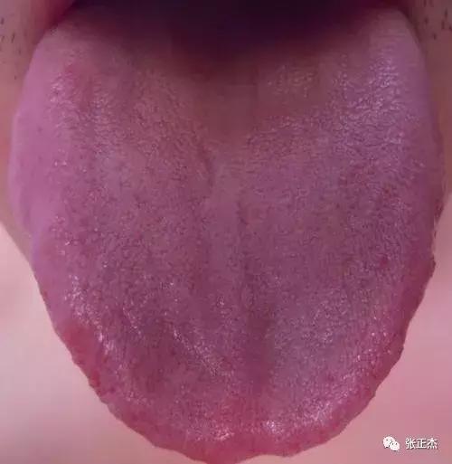 常见五种咳嗽的治疗,一文看懂咳嗽的分类治疗